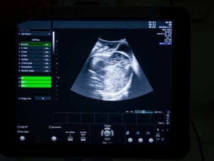 Chicago, IL birth injury lawyer